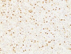 Biotium&nbsp;Luteinizing Hormone beta (LH beta)(LHb/1214), CF647 conjugate, 0.1mg/mL