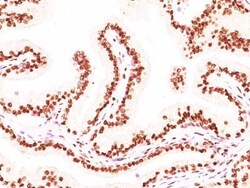 Biotium&nbsp;Androgen Receptor(AR441 + DHTR/882), CF740 conjugate, 0.1mg/mL