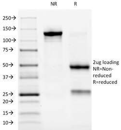 Biotium&nbsp;ALK (Anaplastic Lymphoma Kinase) / CD246(ALK/1032), CF488A conjugate, 0.1mg/mL