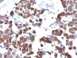 Biotium&nbsp;Thyroglobulin(TGB04 + TGB05), CF594 conjugate, 0.1mg/mL