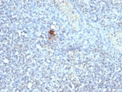 Biotium&nbsp;TRAcP (Tartarate Resistant Acid Phosphatase)(ACP5/1070), CF488A conjugate, 0.1mg/mL