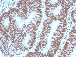 Biotium&nbsp;PAX2 (Renal Cell & Ovarian Carcinoma Marker) (PAX2/1104), CF594 conjugate, 0.1mg/mL