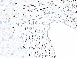 Biotium&nbsp;Human Papillomavirus 16 (HPV-16)(HPV16/1058), CF594 conjugate, 0.1mg/mL