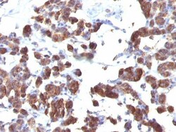 Biotium&nbsp;Thyroglobulin(TGB04 + TGB05), CF594 conjugate, 0.1mg/mL