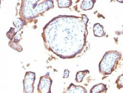 Biotium&nbsp;EGFR(GFR1195), CF640R conjugate, 0.1mg/mL