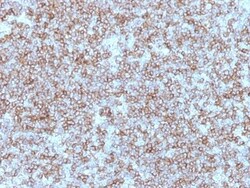 Biotium&nbsp;MHC II (HLA-DP) (beta chain)(Bra-14), CF640R conjugate, 0.1mg/mL
