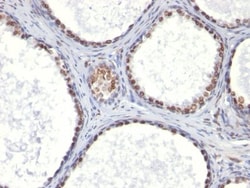 Biotium&nbsp;CD41a(ITGA2B/1036), CF640R conjugate, 0.1mg/mL