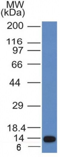 Biotium&nbsp;ALK (Anaplastic Lymphoma Kinase) / CD246(ALK/1031), CF640R conjugate, 0.1mg/mL