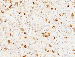 Biotium&nbsp;FSH beta(FSHb/1062), CF594 conjugate, 0.1mg/mL