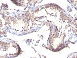 Biotium&nbsp;TGFalpha(TGFA/1119), CF647 conjugate, 0.1mg/mL