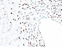 Biotium&nbsp;Human Papillomavirus 16 (HPV-16)(HPV16/1058), CF568 conjugate, 0.1mg/mL