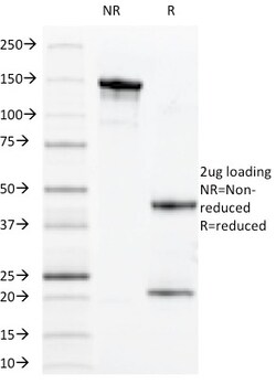 Biotium&nbsp;MUC1 / CA15-3 / EMA / CD227 (Epithelial Marker)(VU-11D1),  CF740 conjugate, 0.1mg/mL