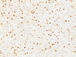 Biotium&nbsp;Luteinizing Hormone beta (LH beta)(LHb/1214), 0.2mg/mL