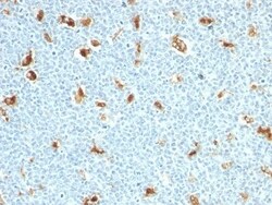 Biotium&nbsp;S100A9(S100A9/1011), 0.2mg/mL