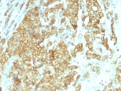 Biotium&nbsp;Glucose Regulated Protein 94 (GRP94)(HSP90B1/1192), CF594 conjugate, 0.1mg/mL