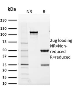 Biotium&nbsp;Aldo-keto Reductase Family 1 Member B1 (Adrenal Marker)(CPTC-AKR1B1-2), 0.2mg/mL