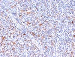 Biotium&nbsp;RCAS1 / Estrogen Receptor Binding Site Associated, Antigen 9(CPTC-EBAG9-2), 0.2mg/mL