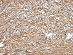 Biotium&nbsp;DOG-1 / TMEM16A (Gastrointestinal Stromal Tumor Marker)(DG1/2831R), CF594 conjugate, 0.1mg/mL