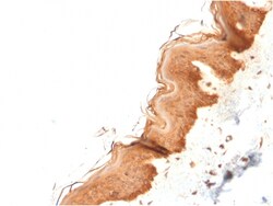 Biotium&nbsp;Cytokeratin 4 (KRT4)(KRT4/2804), Biotin conjugate, 0.1mg/mL