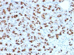 Biotium&nbsp;BARX1 (Prognostic Biomarker in Hepatocellular Carcinoma)(BARX1/2760), 1mg/mL