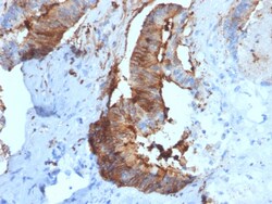 Biotium&nbsp;Cathepsin D (Tumor Marker)(CTSD/2781), 0.2mg/mL