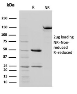 Biotium&nbsp;STAT5B(STAT5B/2657), 0.2mg/mL