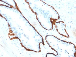 Biotium&nbsp;Cytokeratin 15 (Esophageal Squamous Cell Carcinoma Marker)(KRT15/2554), Biotin conjugate, 0.1mg/mL