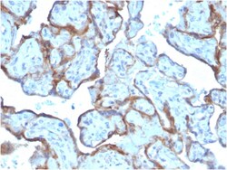 Biotium&nbsp;MMP3 (Marker of Metastasis and Rheumatoid Arthritis)(MMP3/2806), 0.2mg/mL