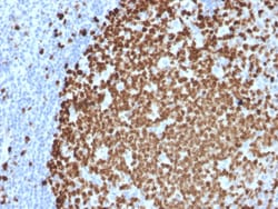 Biotium&nbsp;Ki-67 (Proliferating Cell Marker)(MKI67/2461), CF594 conjugate, 0.1mg/mL