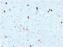 Biotium&nbsp;Calretinin / Calbindin 2 (Mesothelioma Marker)(CALB2/2602), 0.2mg/mL