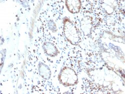 Biotium&nbsp;RAD51 (Prognostic and Response to Chemotherapy Marker)(RAD51/2702), 0.2mg/mL
