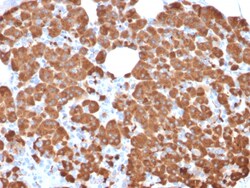 Biotium&nbsp;Carboxypeptidase A1 / CPA1 (Pancreatic Cancer Marker)(CPA1/2711), CF594 conjugate, 0.1mg/mL