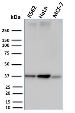 Biotium&nbsp;RAD51 (Prognostic and Response to Chemotherapy Marker)(RAD51/2753), 1mg/mL