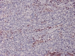 Biotium&nbsp;MSH2 (DNA Mismatch Repair Marker)(MSH2/2622), 1mg/mL