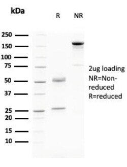 Biotium&nbsp;Desmoglein-3 (Squamous Cell Marker)(DSG3/2796), CF594 conjugate, 0.1mg/mL