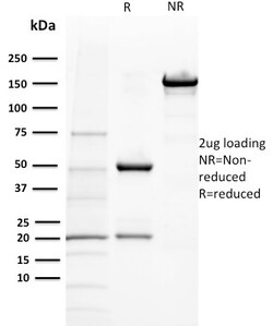 Biotium&nbsp;BAP1 (BRCA1 Associated Protein 1)(BAP1/2432), CF594 conjugate, 0.1mg/mL