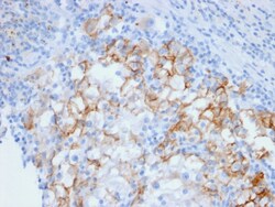 Biotium&nbsp;Ksp-Cadherin / CDH16 (Renal Cell Marker)(CDH16/2448), CF594 conjugate, 0.1mg/mL