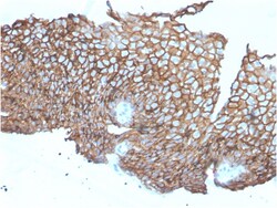 Biotium&nbsp;Desmoglein-3 (Squamous Cell Marker)(DSG3/2840), CF594 conjugate, 0.1mg/mL