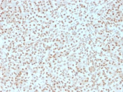 Biotium&nbsp;AKT1 (Prognostic Marker for Neuroendocrine Tumors)(AKT1/2491), 1mg/mL