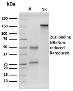 Biotium&nbsp;RET Proto-oncogene(RET/2599), CF594 conjugate, 0.1mg/mL