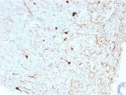Biotium&nbsp;Calretinin / Calbindin 2 (Mesothelioma Marker)(CALB2/2786), CF594 conjugate, 0.1mg/mL