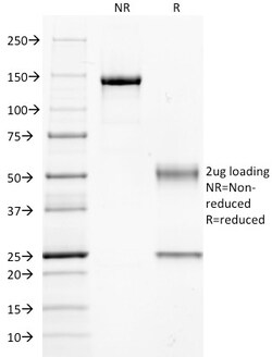 Biotium&nbsp;Guanine nucleotide-binding protein alpha-q / GNAQ / G-ALPHA-q(GNAQ/2434), CF594 conjugate, 0.1mg/mL