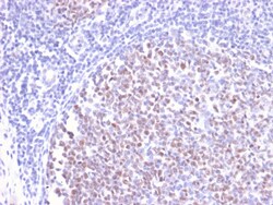 Biotium&nbsp;Bcl-6 (Follicular Lymphoma Marker)(BCL6/2497R), CF594 conjugate, 0.1mg/mL