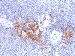 Biotium&nbsp;TRAF1 (TNFR-Associated Factor 1) (Lymphomatoid Papulosis Marker)(TRAF1/2770), CF594 conjugate, 0.1mg/mL