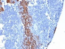 Biotium&nbsp;Cytokeratin 13 (Non-Keratinized Squamous Epithelial Marker)(KRT13/2213), CF594 conjugate, 0.1mg/mL