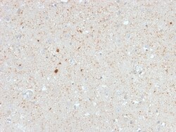 Biotium&nbsp;Calretinin / Calbindin 2 (Mesothelioma Marker)(CALB2/2603), CF568 conjugate, 0.1mg/mL