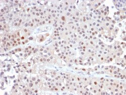 Biotium&nbsp;p21WAF1 (Tumor Suppressor Protein)(CIP1/2489R), CF594 conjugate, 0.1mg/mL