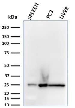 Biotium&nbsp;C1QA / Complement C1q A-Chain(C1QA/2783), 0.2mg/mL