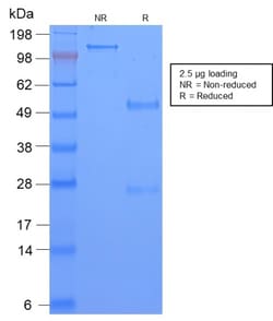 Biotium&nbsp;TAG-72 / CA72.4 (Tumor-Associated Glycoprotein)(CA72/2869R), 0.2mg/mL