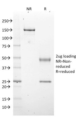 Biotium&nbsp;EZH2 / KMT6(EZH2/2536), CF594 conjugate, 0.1mg/mL